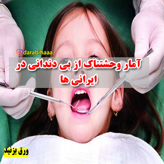 آمار وحشتناک از بی‌دندانی در ایرانی ها